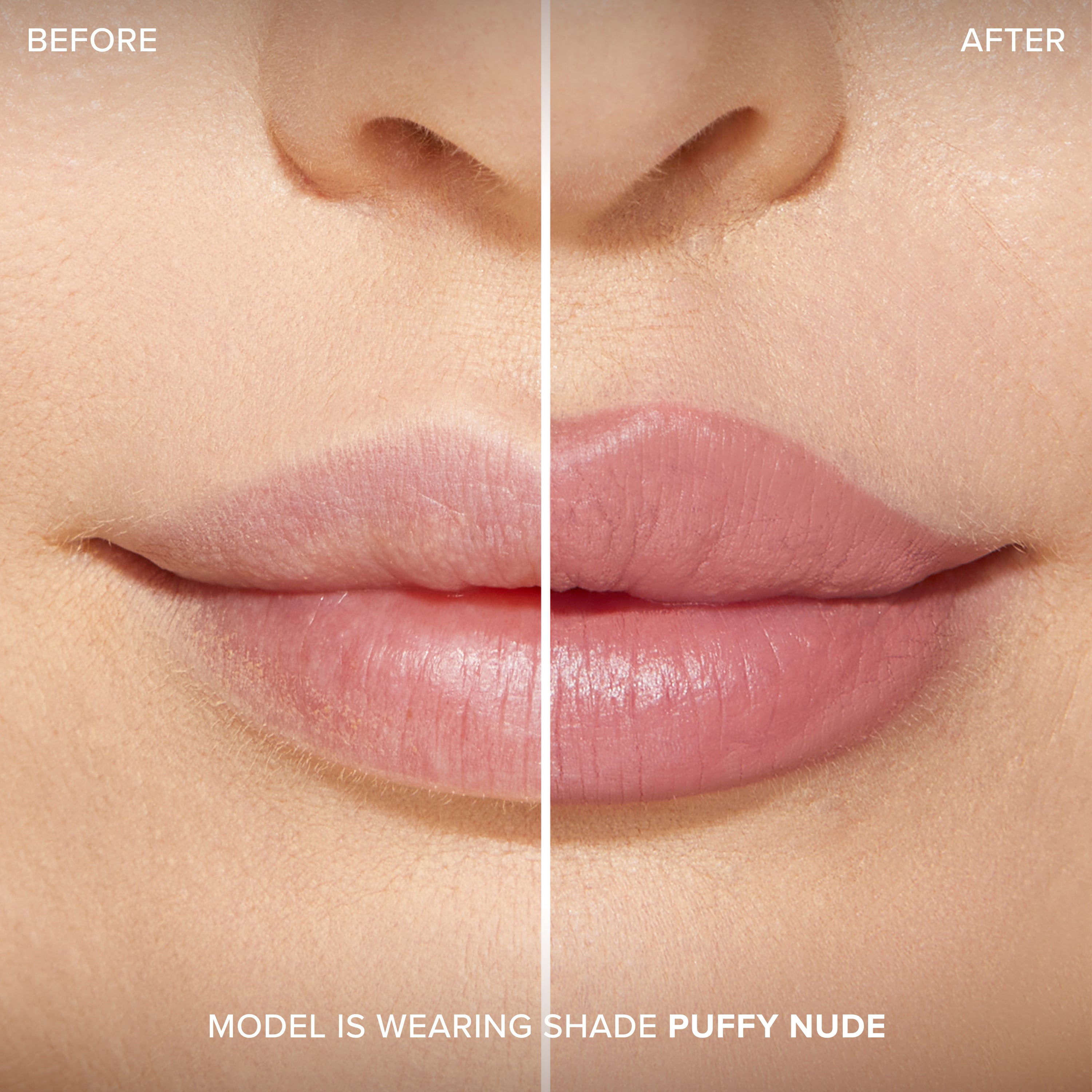 Lip Injection Extreme Lip Shaper